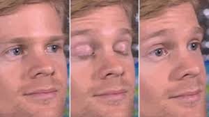 Blinking White Guy meme template